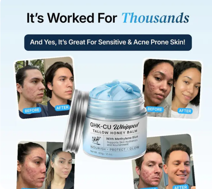 Ombrule Whipped Tallow Honey Balm with Methylene Blue